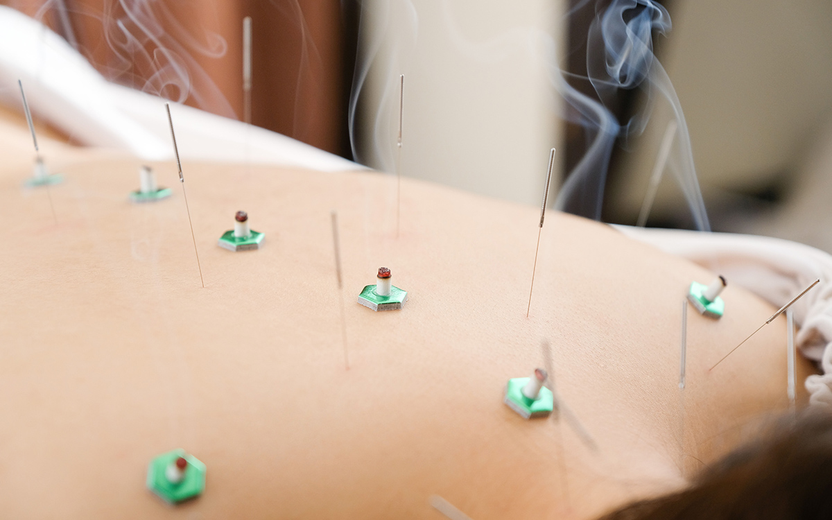 痛みの少ない施術